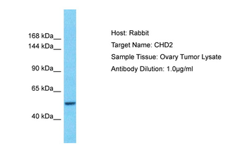CHD2 Rabbit Polyclonal Antibody