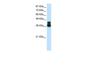 FOXJ1 Rabbit Polyclonal Antibody