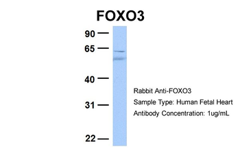 FOXO3 Rabbit Polyclonal Antibody