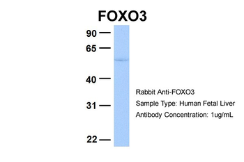 FOXO3 Rabbit Polyclonal Antibody