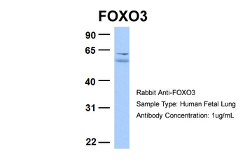 FOXO3 Rabbit Polyclonal Antibody