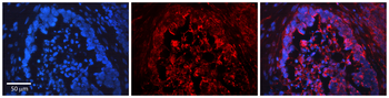 FOXO3 Rabbit Polyclonal Antibody