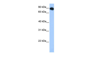FOXO3 Rabbit Polyclonal Antibody