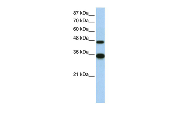 GTF2H4 Rabbit Polyclonal Antibody