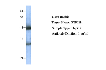 GTF2H4 Rabbit Polyclonal Antibody