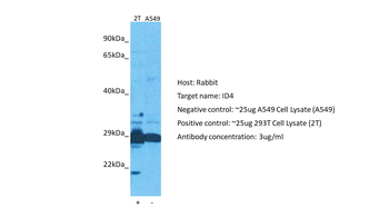 ID4 Rabbit Polyclonal Antibody