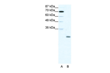 ID4 Rabbit Polyclonal Antibody