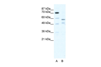 TRIM23 Rabbit Polyclonal Antibody