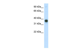 E2F3 Rabbit Polyclonal Antibody