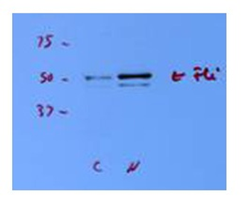 FLI1 Rabbit Polyclonal Antibody