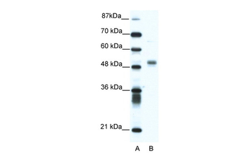 FLI1 Rabbit Polyclonal Antibody