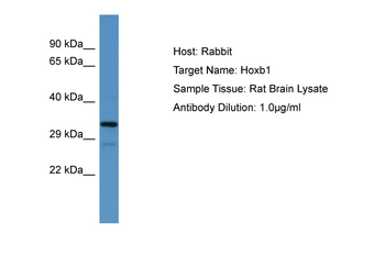 Hoxb1 Rabbit Polyclonal Antibody