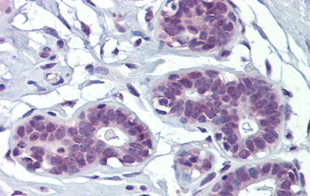 MAZ Rabbit Polyclonal Antibody
