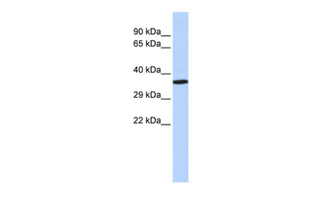 NKX2-2 Rabbit Polyclonal Antibody