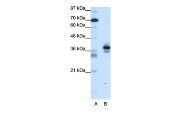 PITX1 Rabbit Polyclonal Antibody