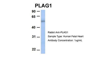 PLAG1 Rabbit Polyclonal Antibody