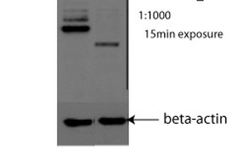 PML Rabbit Polyclonal Antibody