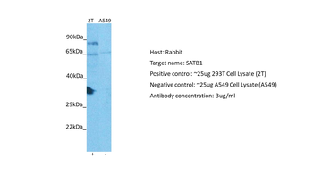 SATB1 Rabbit Polyclonal Antibody