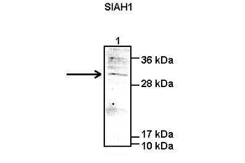 SIAH1 Rabbit Polyclonal Antibody