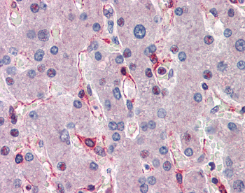 SIAH1 Rabbit Polyclonal Antibody