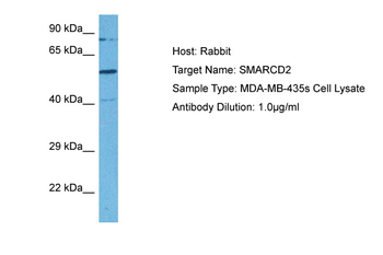 SMARCD2 Rabbit Polyclonal Antibody