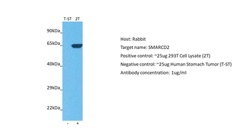 SMARCD2 Rabbit Polyclonal Antibody