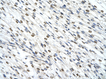 SMARCD2 Rabbit Polyclonal Antibody