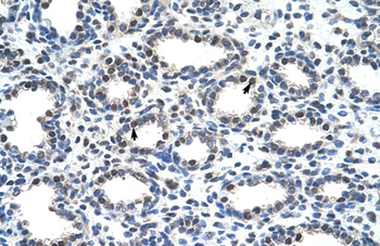 SMARCD2 Rabbit Polyclonal Antibody
