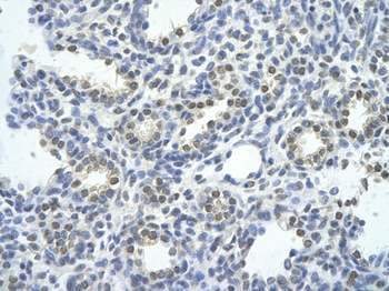 SMARCE1 Rabbit Polyclonal Antibody