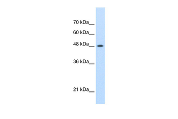 SMARCE1 Rabbit Polyclonal Antibody