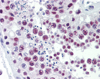 SOX4 Rabbit Polyclonal Antibody