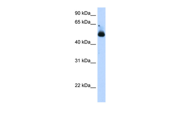 TRIM21 Rabbit Polyclonal Antibody