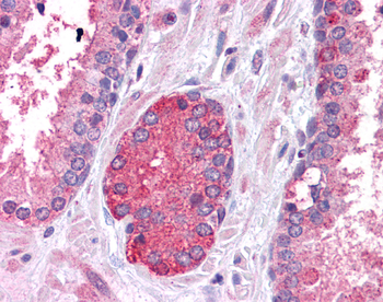STAT3 Rabbit Polyclonal Antibody
