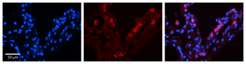 STAT6 Rabbit Polyclonal Antibody