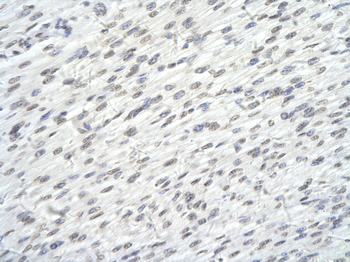 SUPT6H Rabbit Polyclonal Antibody