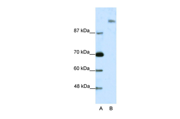 SUPT6H Rabbit Polyclonal Antibody