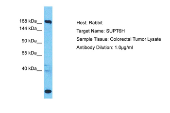 SUPT6H Rabbit Polyclonal Antibody