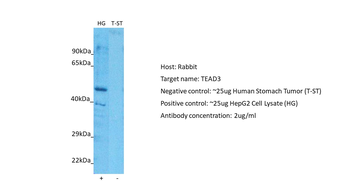 TEAD3 Rabbit Polyclonal Antibody