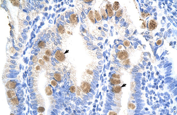 TEAD3 Rabbit Polyclonal Antibody