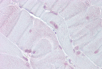 TEF Rabbit Polyclonal Antibody