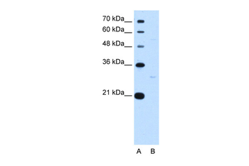 TEF Rabbit Polyclonal Antibody