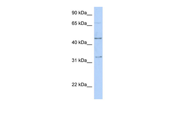 TFAP2B Rabbit Polyclonal Antibody