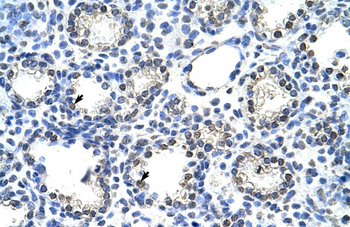 NR2C1 Rabbit Polyclonal Antibody
