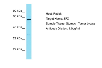 ZFX Rabbit Polyclonal Antibody