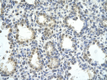 ZNF264 Rabbit Polyclonal Antibody