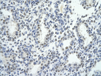 ZNF264 Rabbit Polyclonal Antibody