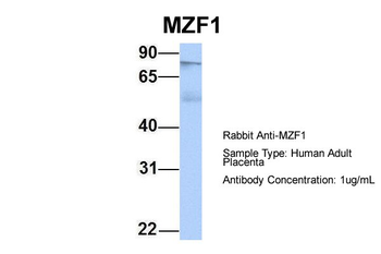 MZF1 Rabbit Polyclonal Antibody
