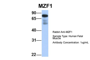 MZF1 Rabbit Polyclonal Antibody