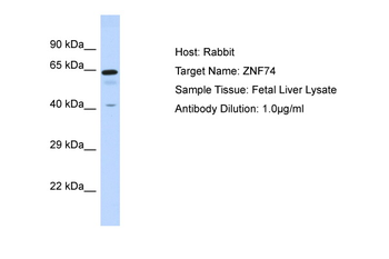 ZNF74 Rabbit Polyclonal Antibody