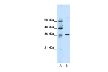 ZNF124 Rabbit Polyclonal Antibody